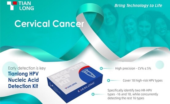 TianLong HPV Nucleic Acid Detection Kit Could Enable Early Detection of Cervical Cancer